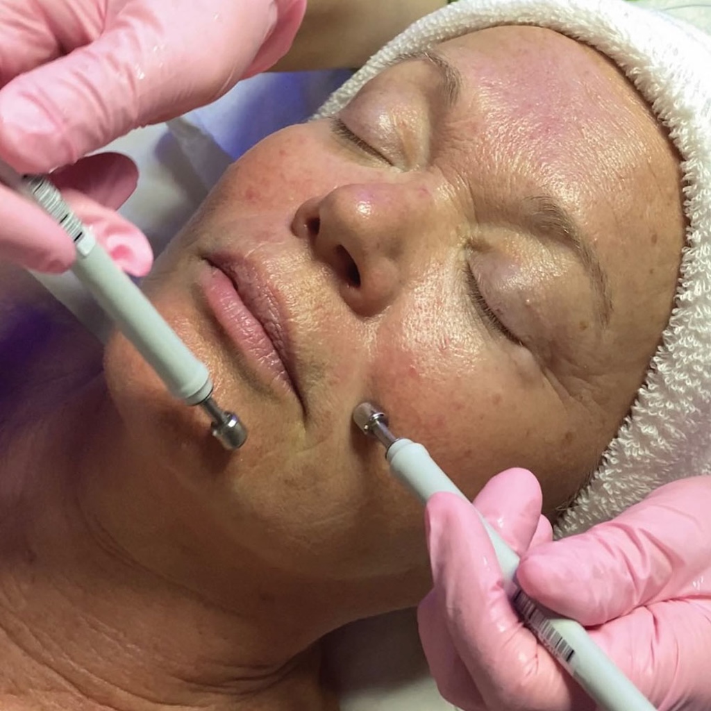 Wellbeing Treatments | Non-Invasive Face Lift